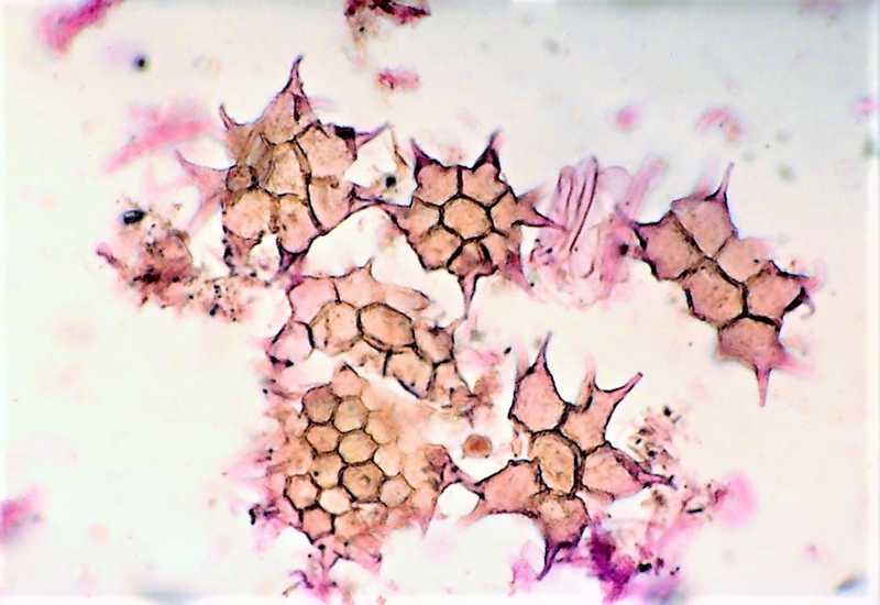 Coenobia zelené chlorokokální řasy Pediastrum simplex.