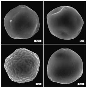 Pylová zrna břízy, habru (nahoře); jilmu a lísky (dole). Environmentální skenovací elektronová mikroskopie (ESEM). Foto J. Machač