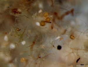 Drobné spory druhu Rhizophagus irregularis. Tento druh dobře snáší podmínky orných půd, protože rychle kolonizuje kořeny rostlin z kousků odumřelých kořenů nebo dokonce jen úlomků mycelia v půdě. Foto J. Machač