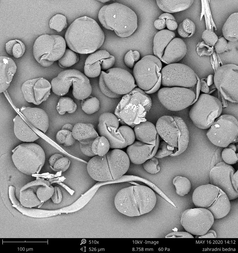 Snímek recentních pylových zrn jehličnanů z elektronového mikroskopu, zvětšení 510x.